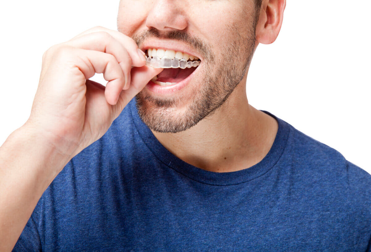 what happens if you don't wear your invisalign trays for a few days?