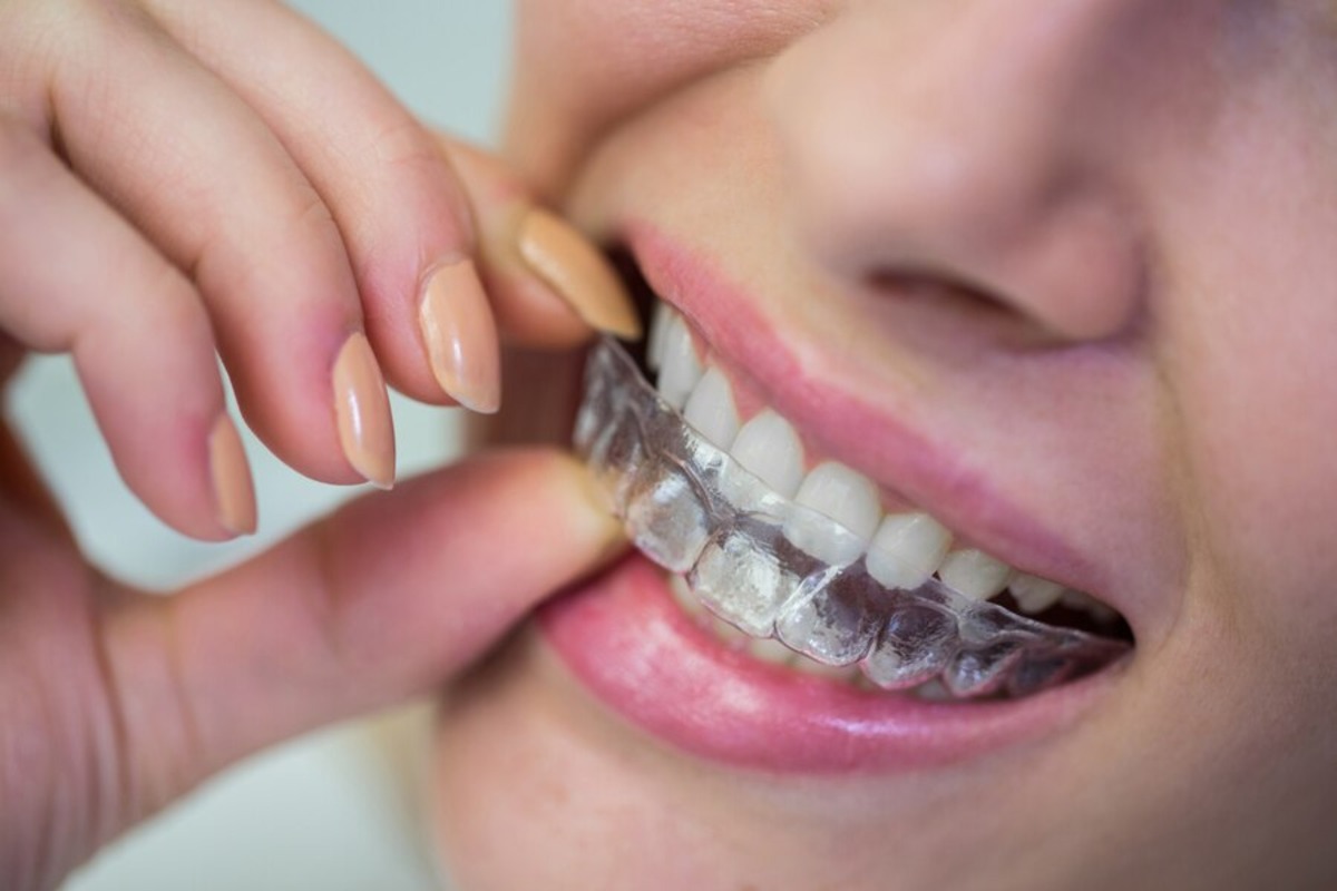 invisalign maintenance tips for busy adults