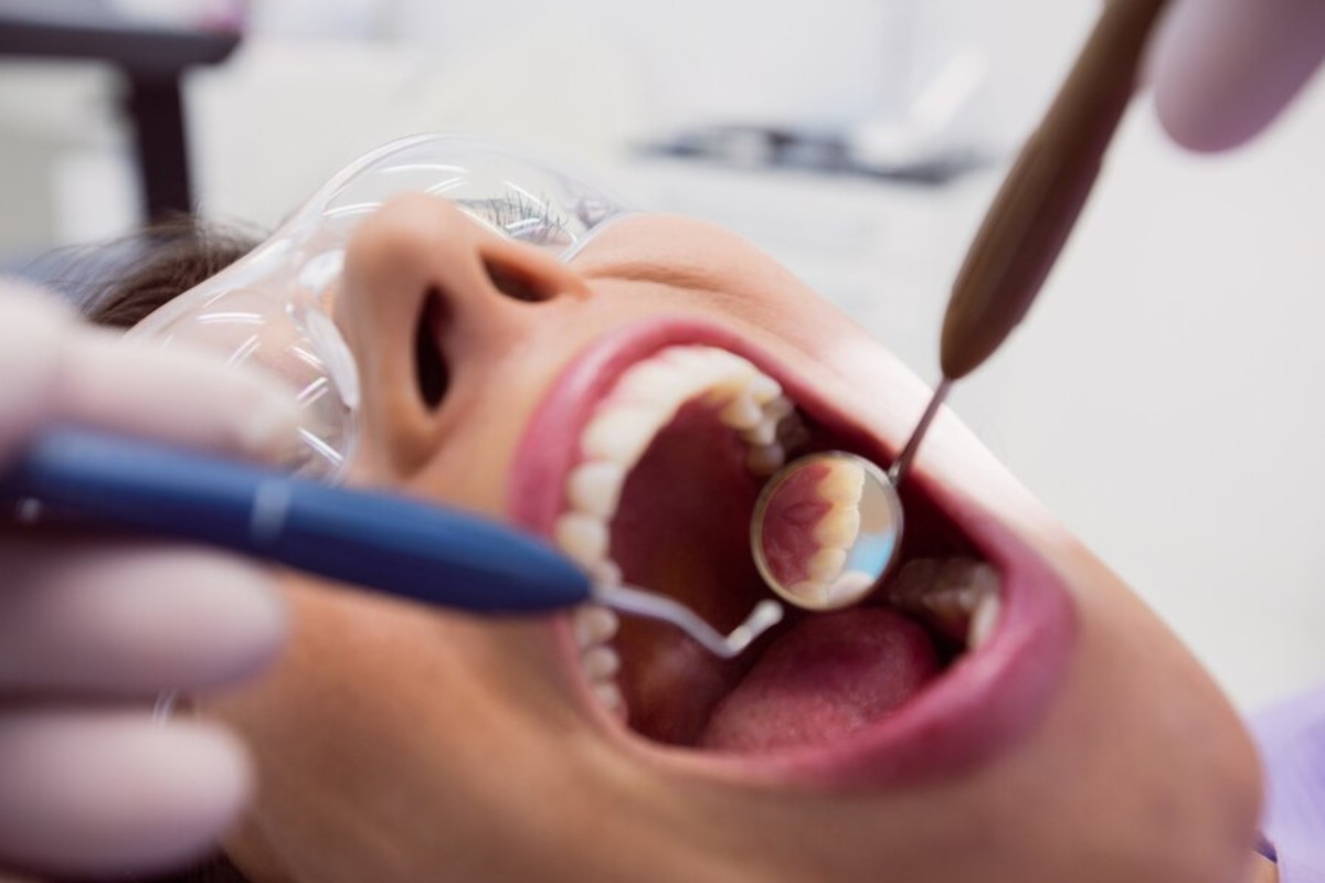 understanding the requirement of tooth extractions