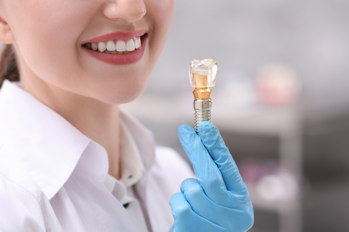 dental implants: the best solution for missing teeth