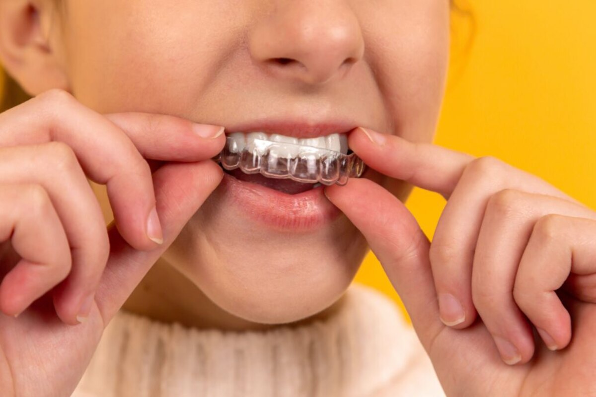 does invisalign work faster than braces