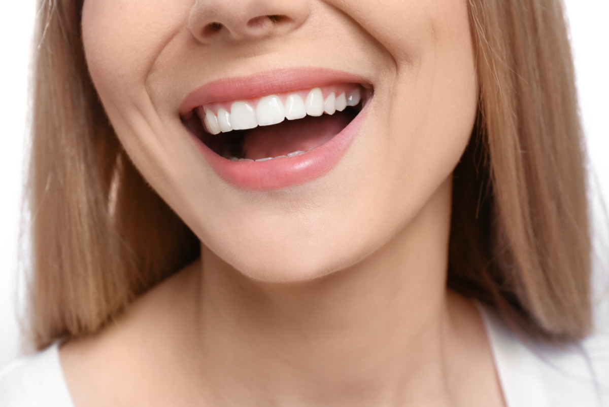 myth or fact do smile makeovers look natural